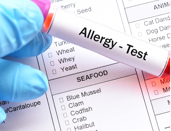 장갑 낀 손에 든 'Allergy - Test' 채혈관과 알레르기 항목 검사지 사진