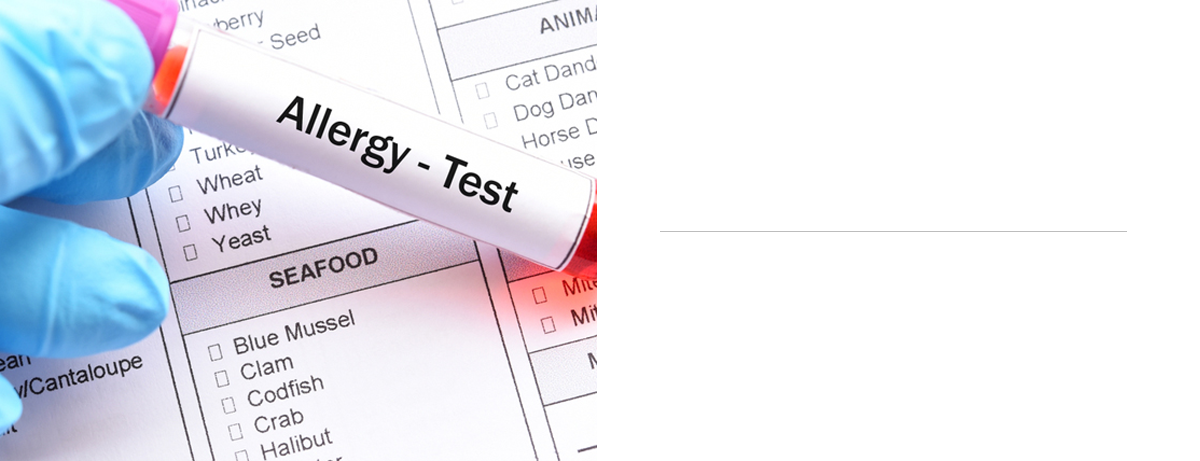 MAST ALLERGY 108종 검사 — Allergy Test 채혈관과 알레르기 검사지 사진